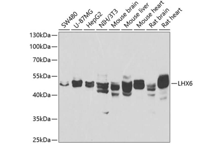 Western Blot - Anti-LHX6 Antibody (A12106) - Antibodies.com
