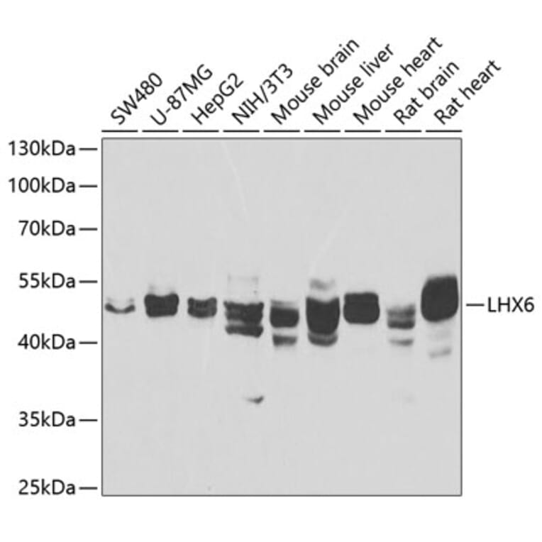 Western Blot - Anti-LHX6 Antibody (A12106) - Antibodies.com