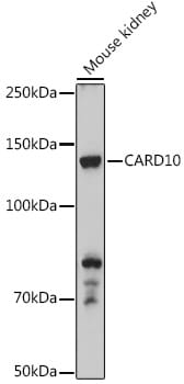 Western blot analysis of extracts of various cell lines, using Anti-CARD10 Antibody (A7368) at 1:1,000 dilution.
Secondary antibody: Goat Anti-Rabbit IgG (H+L) (HRP) (AS014) at 1:10,000 dilution.
Lysates / proteins: 25µg per lane.
Blocking buffer: 3% non-fat dry milk in TBST.
Detection: ECL Enhanced Kit (RM00021).
Exposure time: 90s.