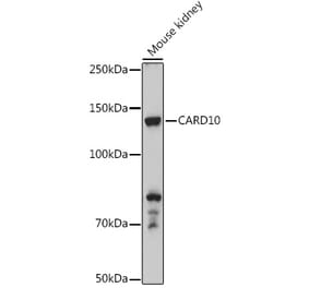 Western Blot - Anti-Carma 3 Antibody (A12107) - Antibodies.com
