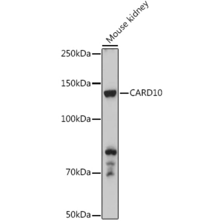 Western Blot - Anti-Carma 3 Antibody (A12107) - Antibodies.com