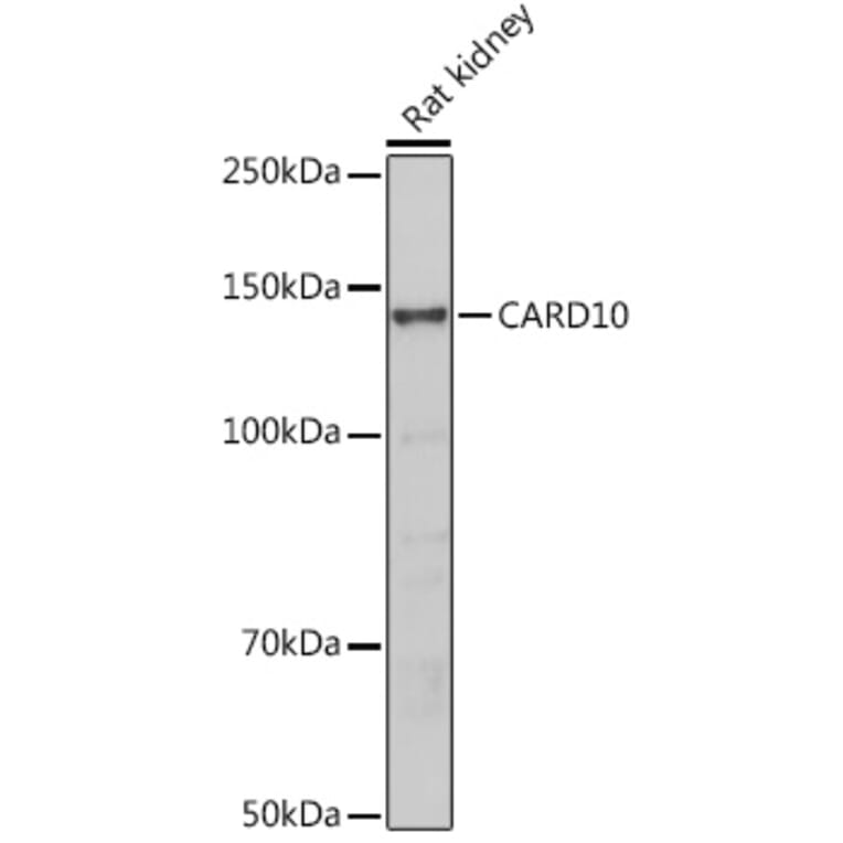 Western Blot - Anti-Carma 3 Antibody (A12107) - Antibodies.com