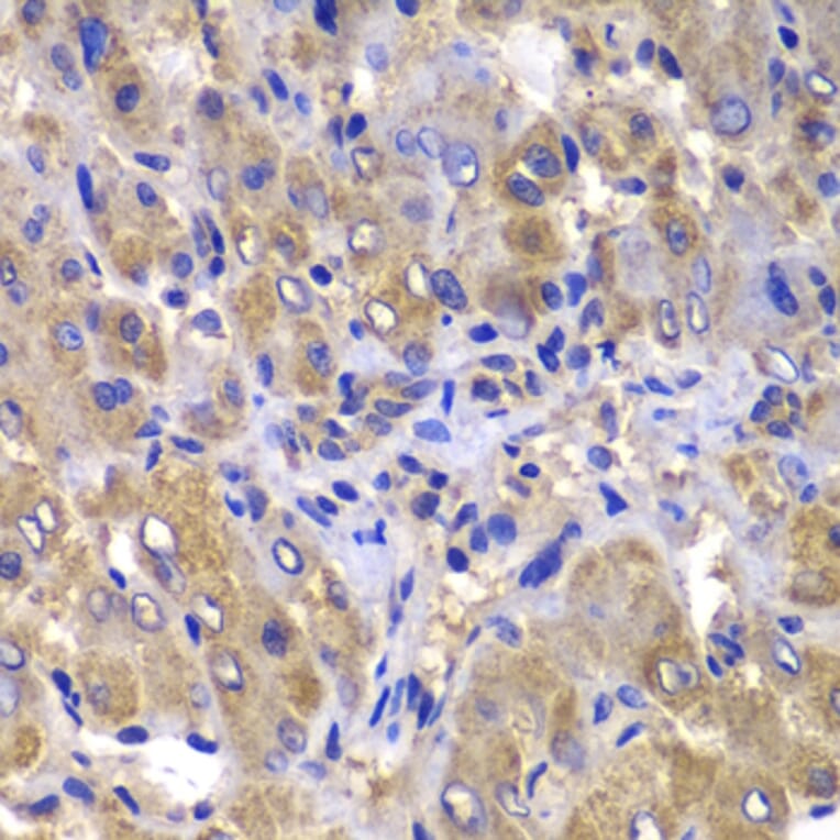Immunohistochemistry - Anti-Carma 3 Antibody (A12107) - Antibodies.com