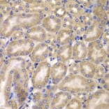 Immunohistochemistry - Anti-Carma 3 Antibody (A12107) - Antibodies.com