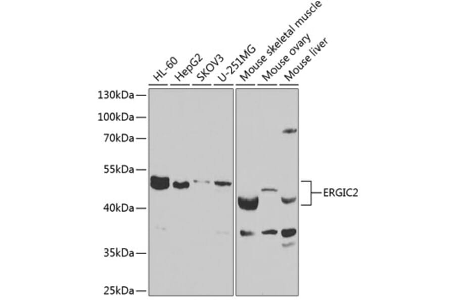 Western Blot - Anti-ERGIC2 Antibody (A12108) - Antibodies.com