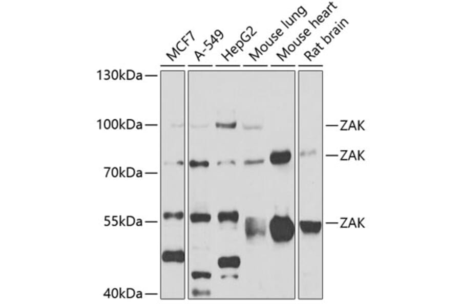 Western Blot - Anti-ZAK Antibody (A12109) - Antibodies.com
