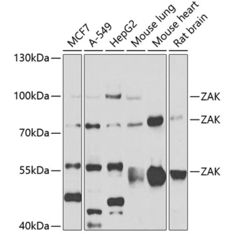 Western Blot - Anti-ZAK Antibody (A12109) - Antibodies.com