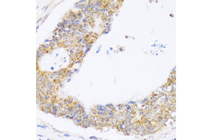 Immunohistochemistry - Anti-ZAK Antibody (A12109) - Antibodies.com