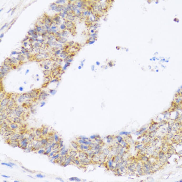 Immunohistochemistry - Anti-ZAK Antibody (A12109) - Antibodies.com