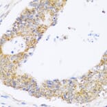 Immunohistochemistry - Anti-ZAK Antibody (A12109) - Antibodies.com