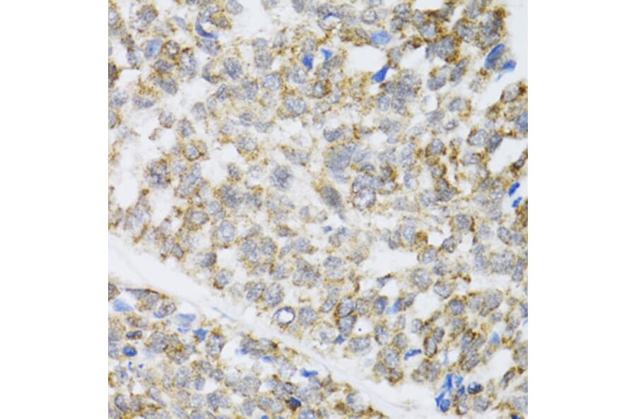 Immunohistochemistry - Anti-ZAK Antibody (A12109) - Antibodies.com