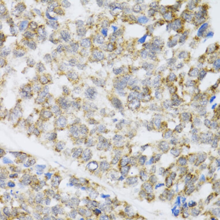 Immunohistochemistry - Anti-ZAK Antibody (A12109) - Antibodies.com