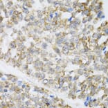 Immunohistochemistry - Anti-ZAK Antibody (A12109) - Antibodies.com