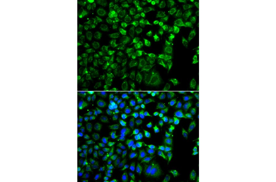 Immunofluorescence - Anti-ZAK Antibody (A12109) - Antibodies.com