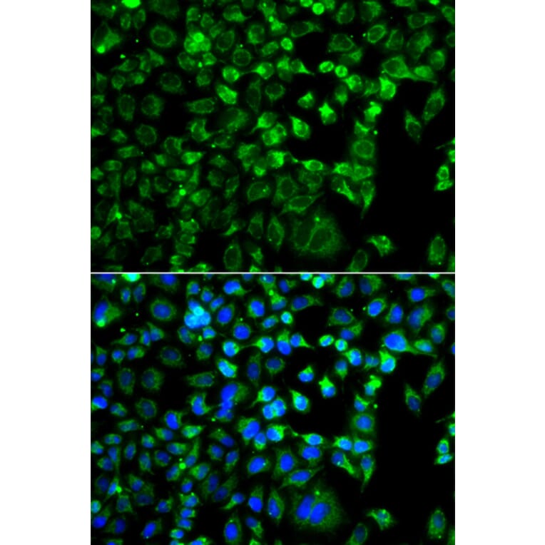 Immunofluorescence - Anti-ZAK Antibody (A12109) - Antibodies.com