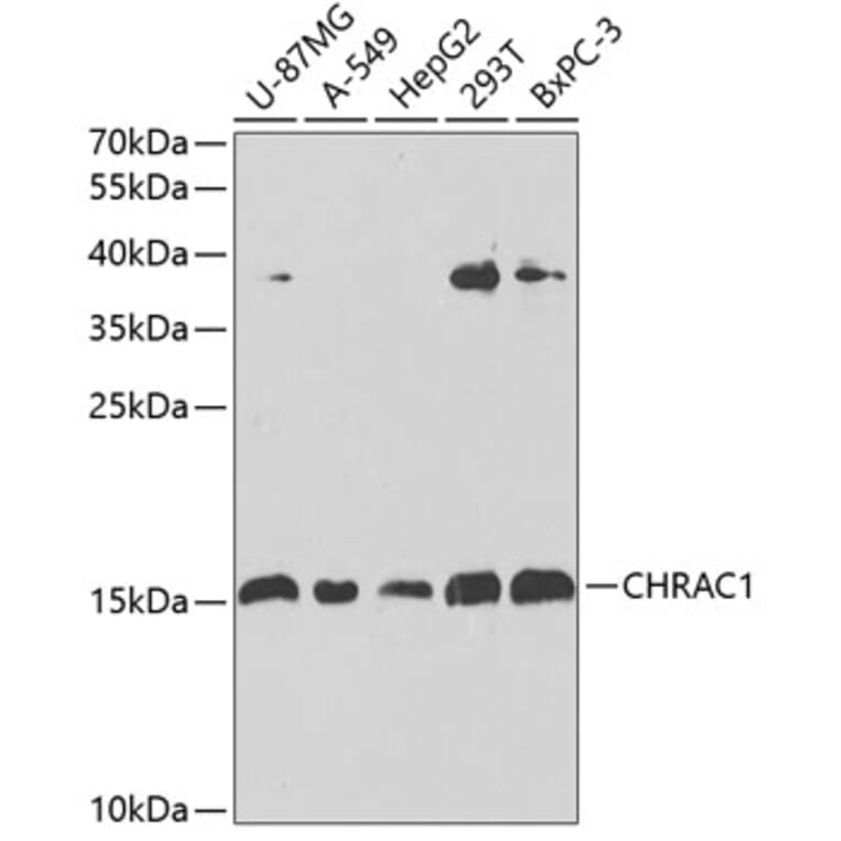 Western Blot - Anti-CHRAC1 Antibody (A12110) - Antibodies.com
