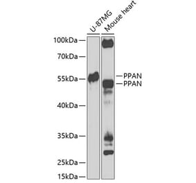 Western Blot - Anti-PPAN Antibody (A12111) - Antibodies.com