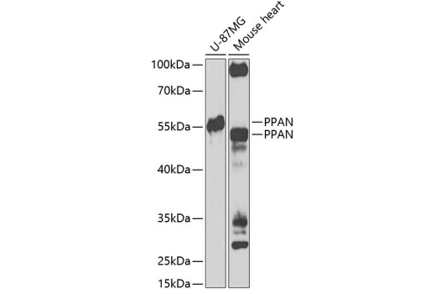 Western Blot - Anti-PPAN Antibody (A12111) - Antibodies.com