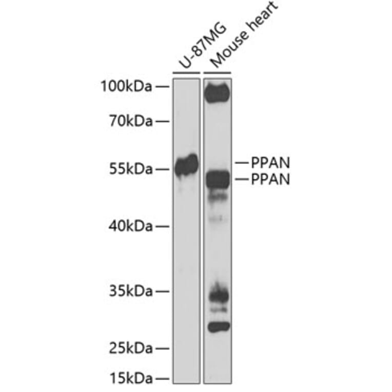 Western Blot - Anti-PPAN Antibody (A12111) - Antibodies.com