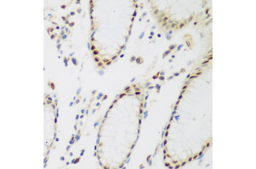 Immunohistochemistry - Anti-PPAN Antibody (A12111) - Antibodies.com