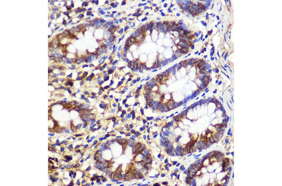 Immunohistochemistry - Anti-ATG10 Antibody (A12112) - Antibodies.com
