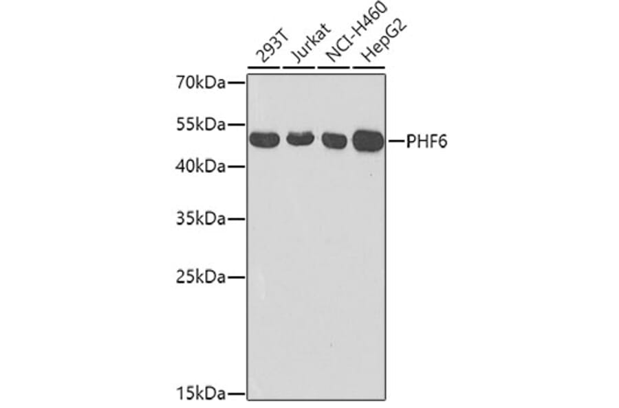 Western Blot - Anti-PHD finger protein 6 / PHF6 Antibody (A12113) - Antibodies.com