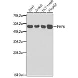Western Blot - Anti-PHD finger protein 6 / PHF6 Antibody (A12113) - Antibodies.com