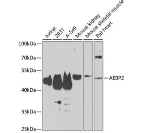 Western Blot - Anti-AEBP2 Antibody (A12114) - Antibodies.com