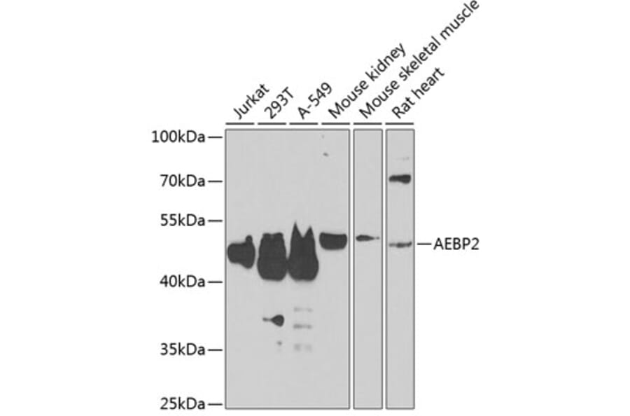 Western Blot - Anti-AEBP2 Antibody (A12114) - Antibodies.com