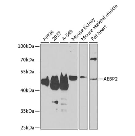 Western Blot - Anti-AEBP2 Antibody (A12114) - Antibodies.com