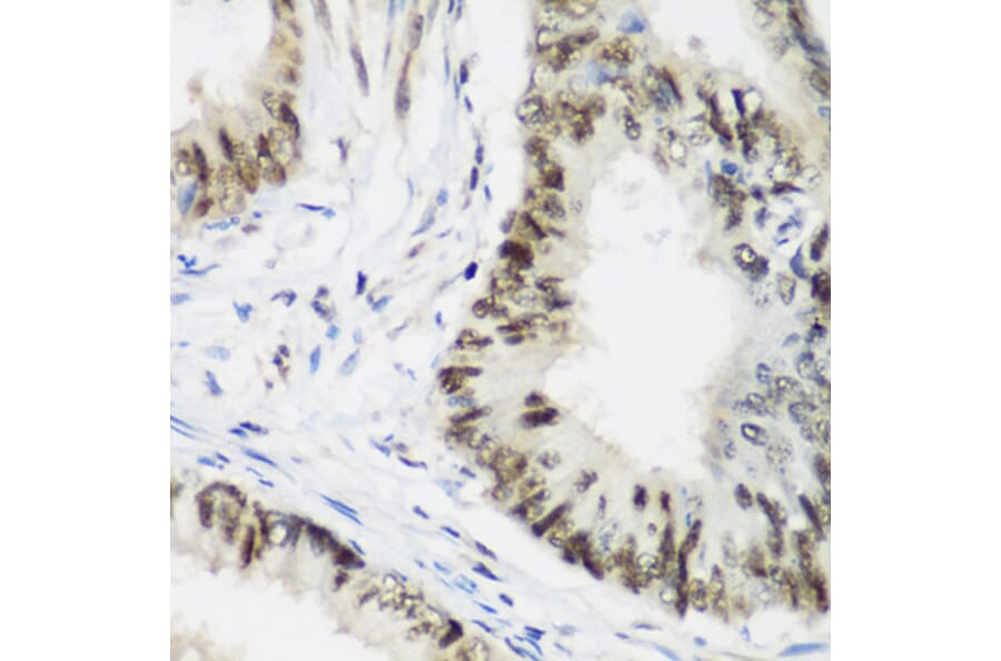 Immunohistochemistry - Anti-AEBP2 Antibody (A12114) - Antibodies.com