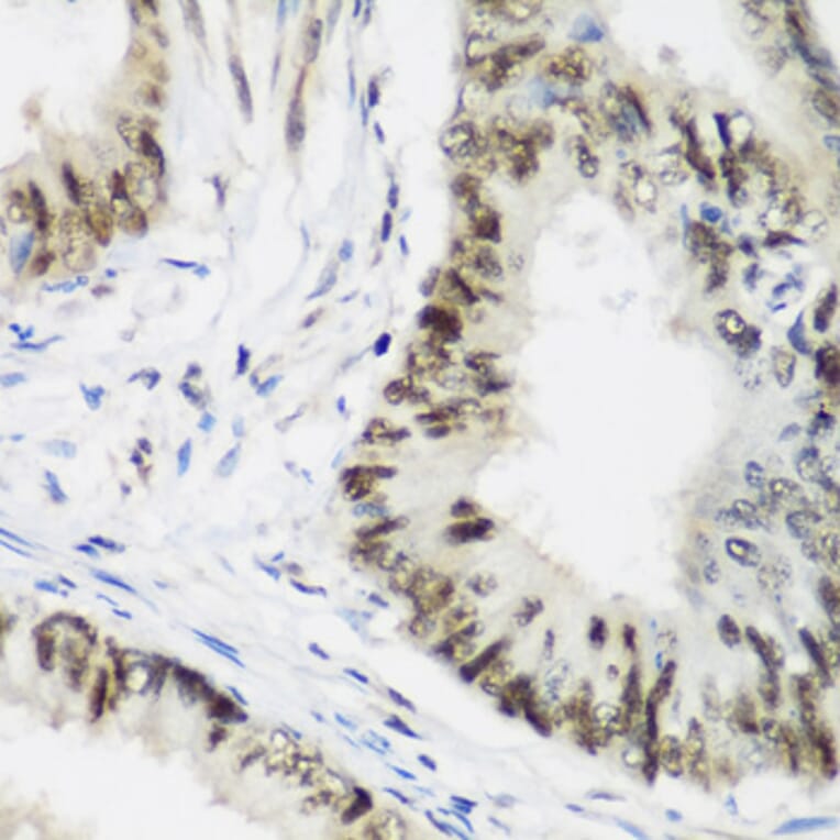 Immunohistochemistry - Anti-AEBP2 Antibody (A12114) - Antibodies.com