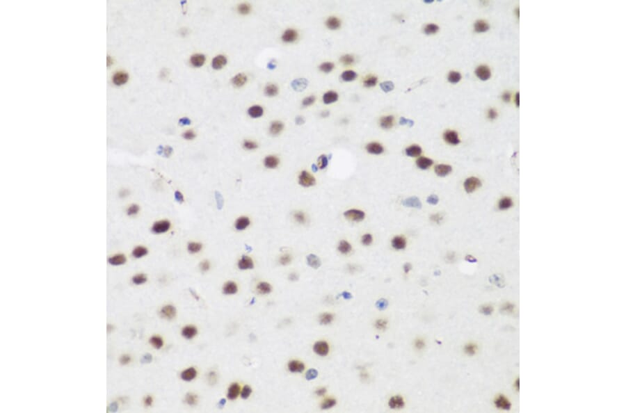 Immunohistochemistry - Anti-AEBP2 Antibody (A12114) - Antibodies.com