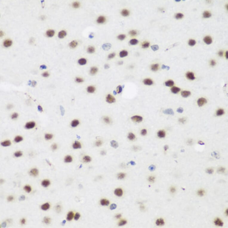 Immunohistochemistry - Anti-AEBP2 Antibody (A12114) - Antibodies.com