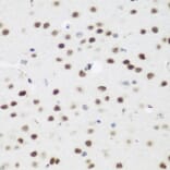 Immunohistochemistry - Anti-AEBP2 Antibody (A12114) - Antibodies.com