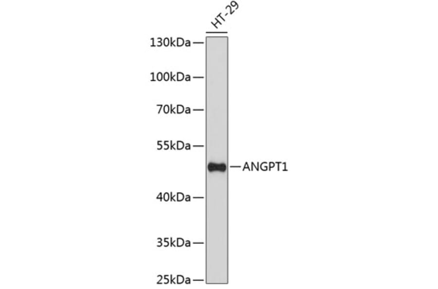 Western Blot - Anti-ANGPT1 Antibody (A7413) - Antibodies.com