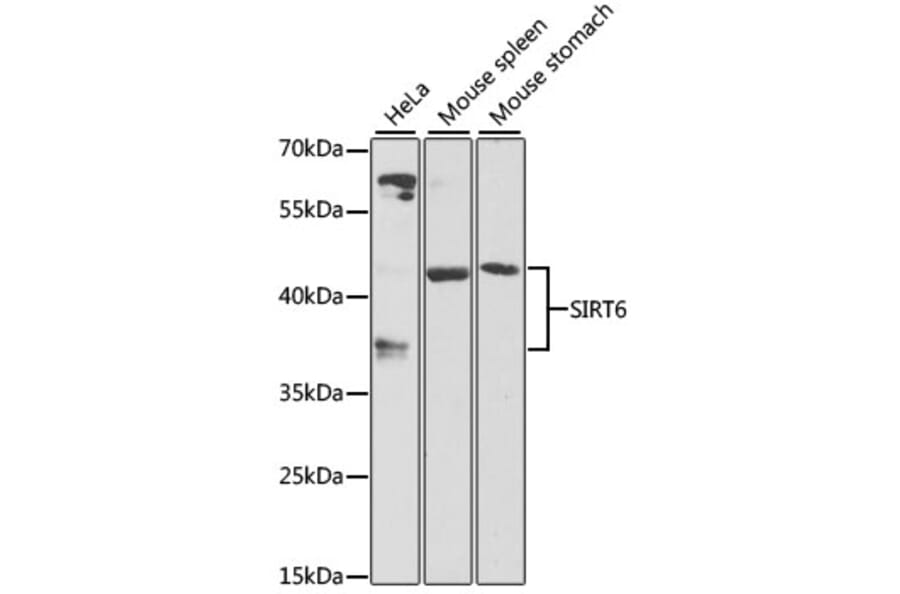 Western Blot - Anti-SIRT6 Antibody (A12116) - Antibodies.com