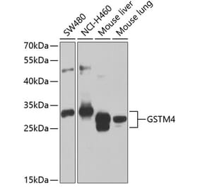 Western Blot - Anti-GSTM4 Antibody (A12117) - Antibodies.com