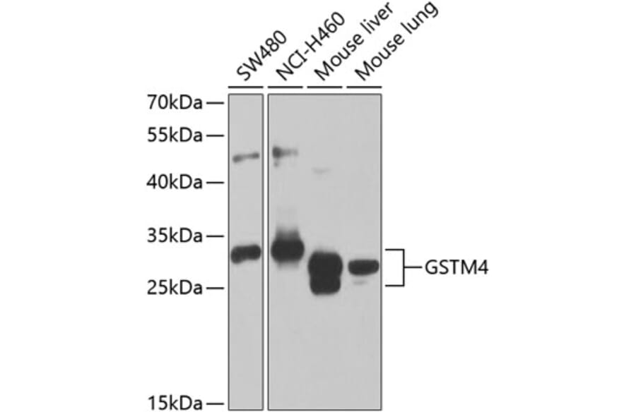 Western Blot - Anti-GSTM4 Antibody (A12117) - Antibodies.com