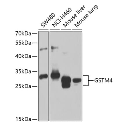 Western Blot - Anti-GSTM4 Antibody (A12117) - Antibodies.com