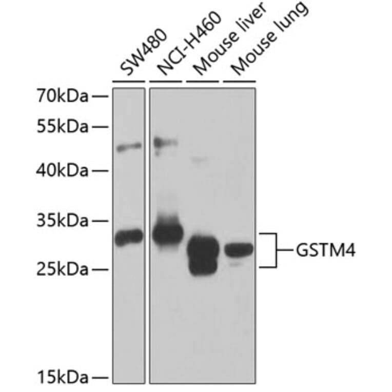 Western Blot - Anti-GSTM4 Antibody (A12117) - Antibodies.com