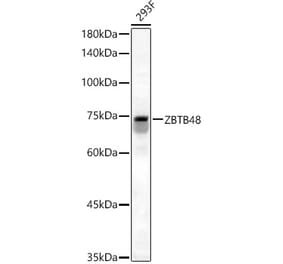 Western Blot - Anti-ZBTB48 Antibody (A12118) - Antibodies.com