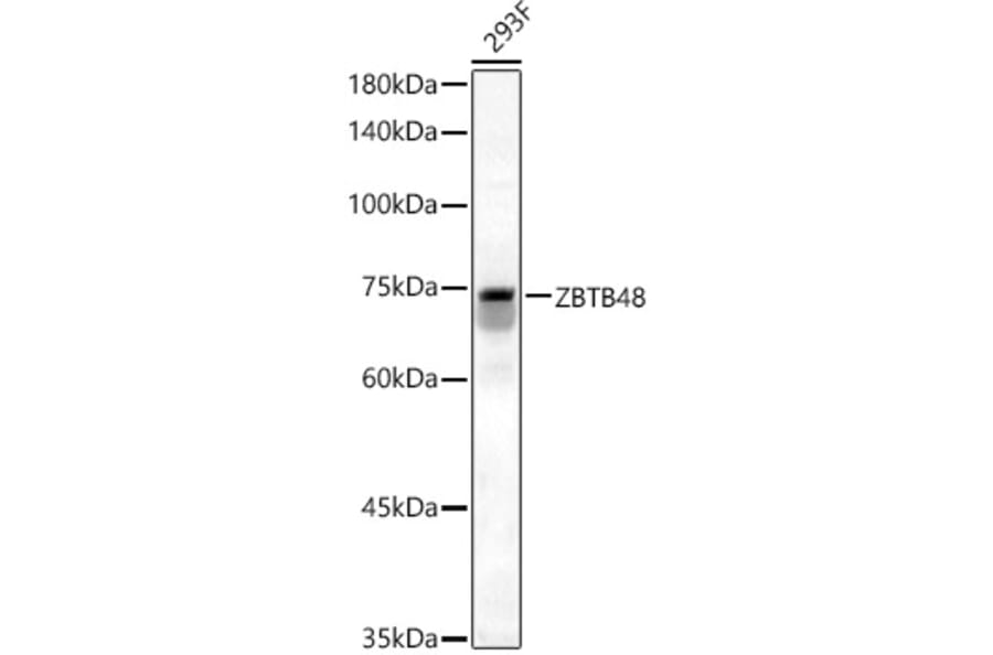 Western Blot - Anti-ZBTB48 Antibody (A12118) - Antibodies.com