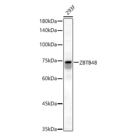 Western Blot - Anti-ZBTB48 Antibody (A12118) - Antibodies.com