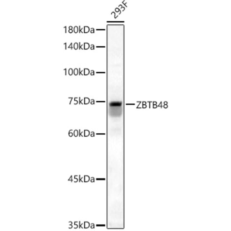 Western Blot - Anti-ZBTB48 Antibody (A12118) - Antibodies.com
