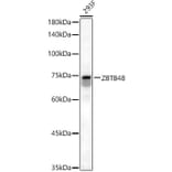 Western Blot - Anti-ZBTB48 Antibody (A12118) - Antibodies.com