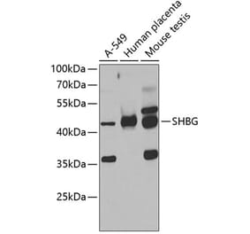 Western Blot - Anti-SHBG Antibody (A12120) - Antibodies.com