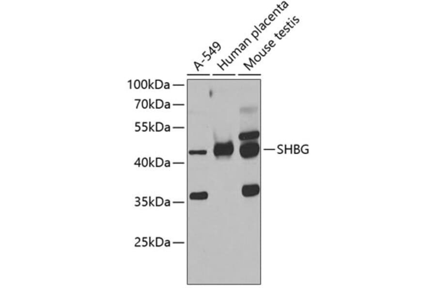 Western Blot - Anti-SHBG Antibody (A12120) - Antibodies.com