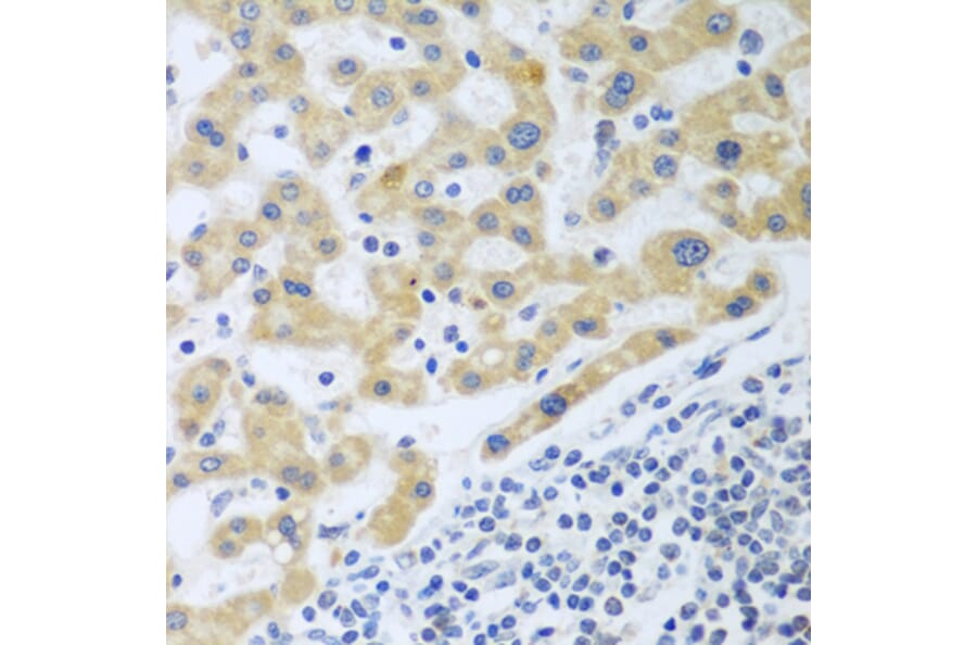 Immunohistochemistry - Anti-SHBG Antibody (A12120) - Antibodies.com