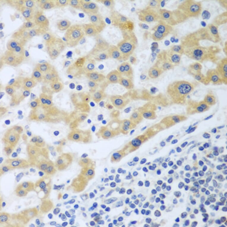 Immunohistochemistry - Anti-SHBG Antibody (A12120) - Antibodies.com